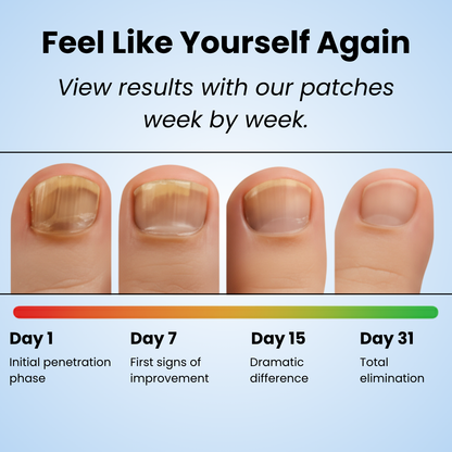 Glovoro™ - Fungal Nail Patches